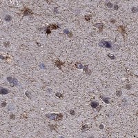 HPA IHC Cerebral cortex — ALDH7A1