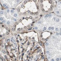 HPA IHC Kidney — PTPN11