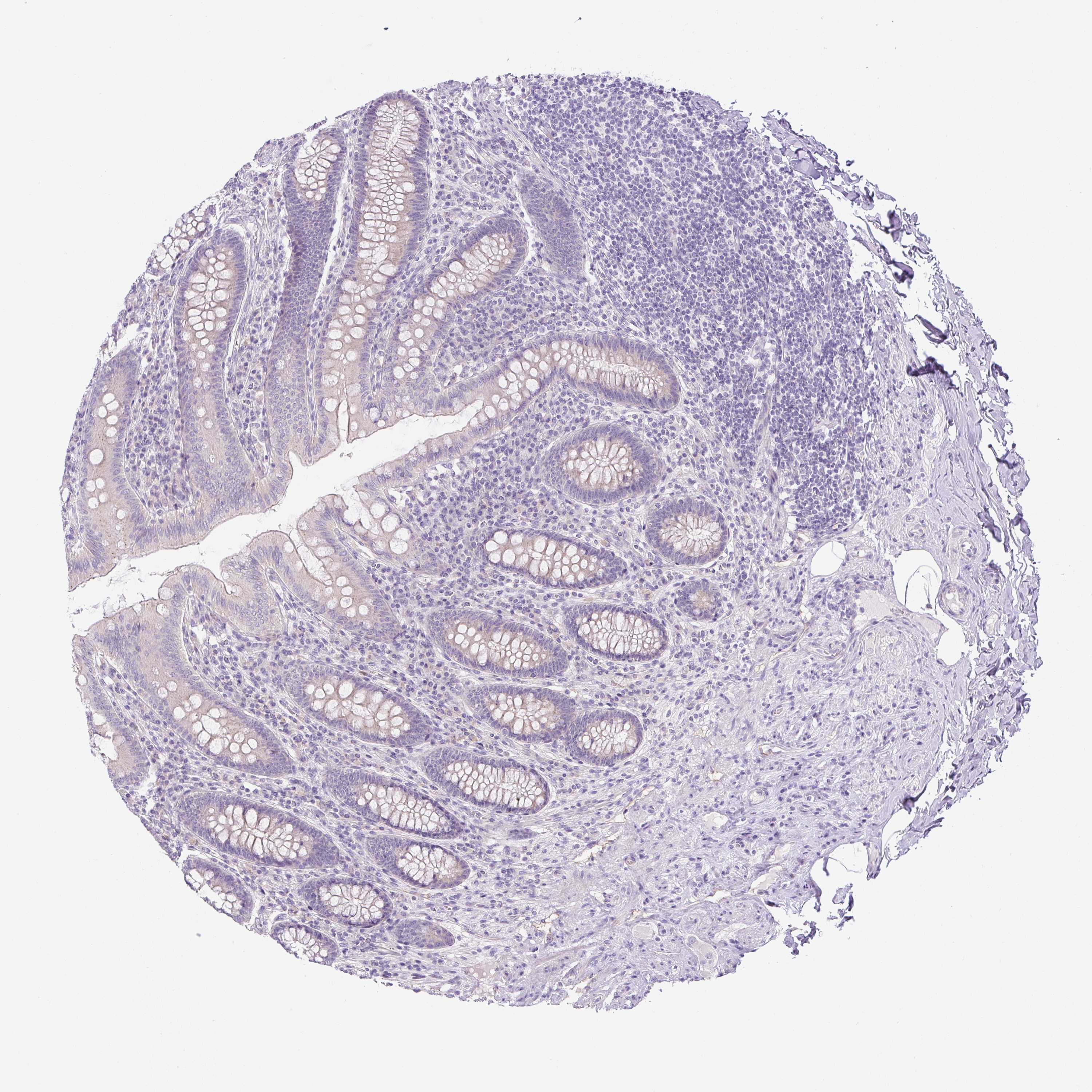 Tissue expression of UBL3 Staining in appendix The Human Protein Atlas