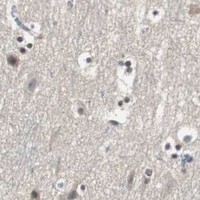 HPA IHC Cerebral cortex — SMAD1