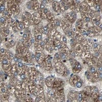 HPA IHC Liver — SOS1