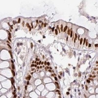 HPA IHC Colon — MYSM1