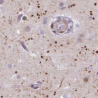 HPA IHC Cerebral cortex — MYSM1