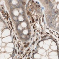 HPA IHC Colon — BIN1