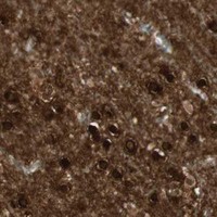 HPA IHC Cerebral cortex — BIN1