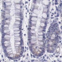 HPA IHC Colon — MAST4