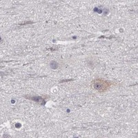 HPA IHC Cerebral cortex — MAST4