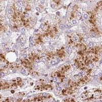 HPA IHC Liver — TMC8
