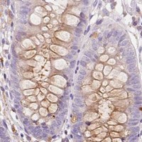 HPA IHC Colon — TMC8