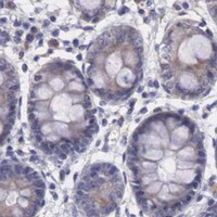 HPA IHC Colon — NREP