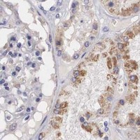 HPA IHC Kidney — NREP
