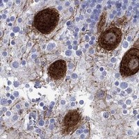 HPA IHC Cerebellum — PRKCG