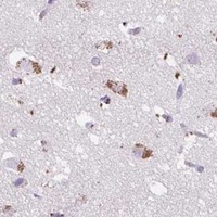 HPA IHC Cerebral cortex — HEXA