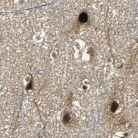 HPA IHC Cerebral cortex — PSMC4