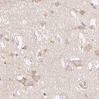 HPA IHC Cerebral cortex — MYO1D