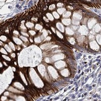 HPA IHC Colon — TICAM1