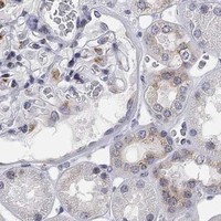 HPA IHC Kidney — TICAM1