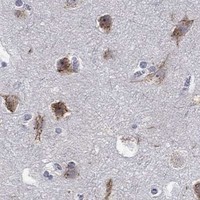 HPA IHC Cerebral cortex — TICAM1