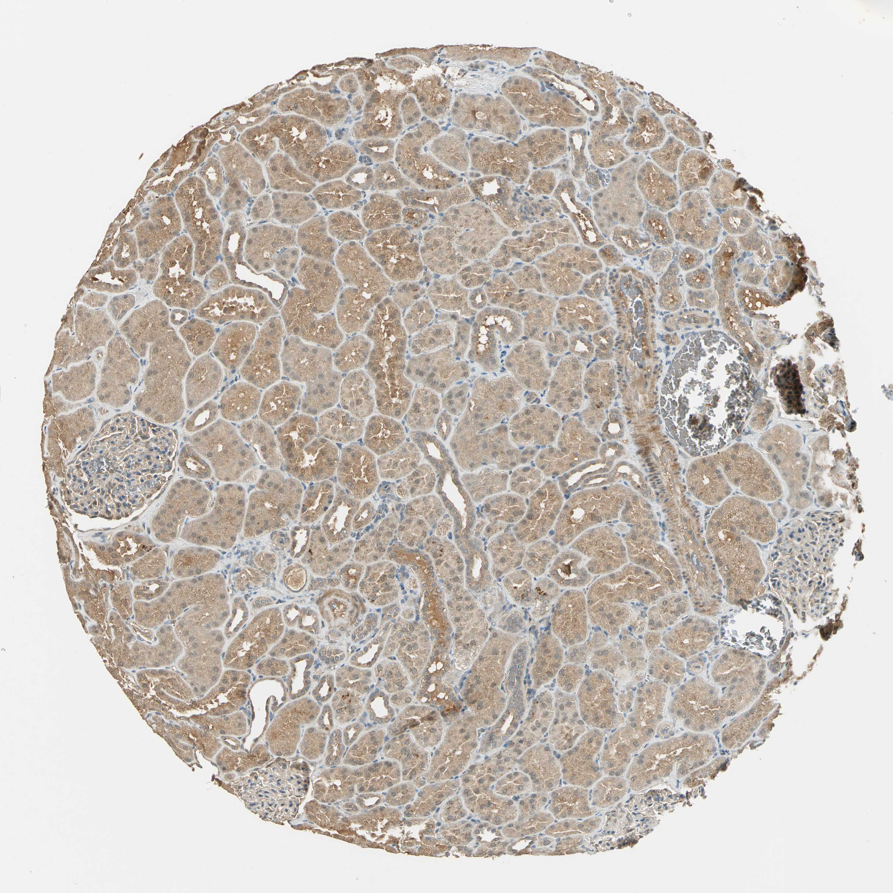 Tissue expression of KEAP1 Staining in kidney The Human Protein Atlas