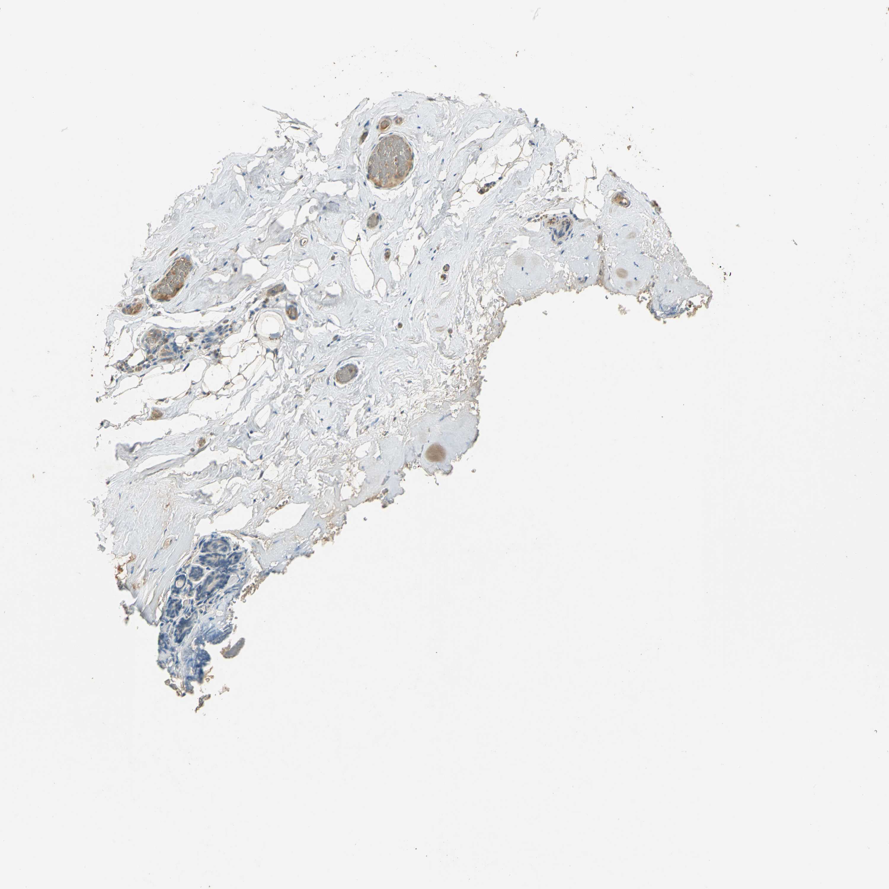 Tissue expression of KEAP1 Staining in breast The Human Protein Atlas