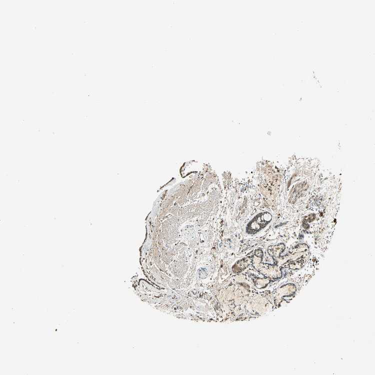 Tissue expression of KEAP1 Staining in bronchus The Human Protein Atlas