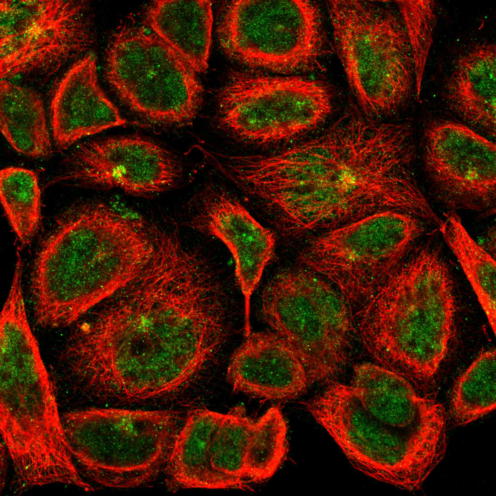 Subcellular KEAP1 The Human Protein Atlas
