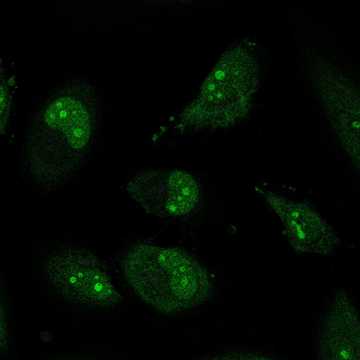 HPA055677: HeLa 