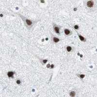 HPA IHC Cerebral cortex — HDAC3