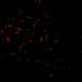HPA055861: U-2 OS, siRNA 1 (10x)