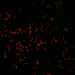 HPA055861: U-2 OS, siRNA 2 (10x)