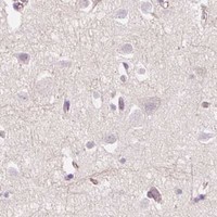 HPA IHC Cerebral cortex — CCL25