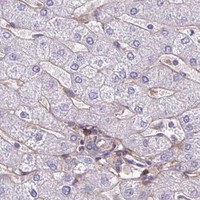 HPA IHC Liver — TNS3