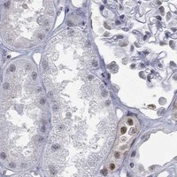 HPA IHC Kidney — GATA2