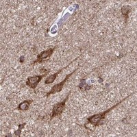 HPA IHC Cerebral cortex — RPS7