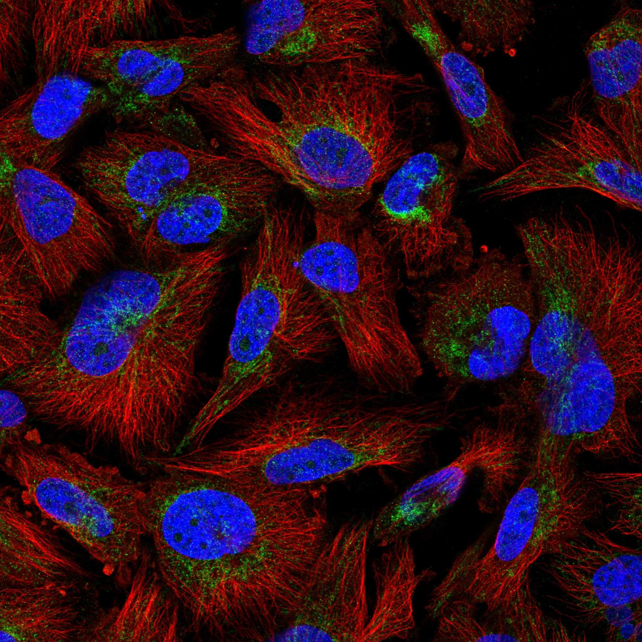 Subcellular MARCHF5 The Human Protein Atlas