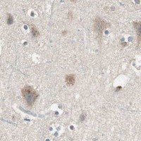 HPA IHC Cerebral cortex — TRIM21