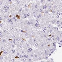 HPA IHC Liver — HK3