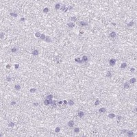 HPA IHC Cerebral cortex — HK3