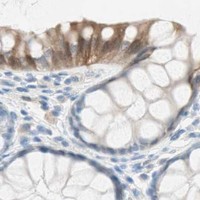 HPA IHC Colon — HPGD