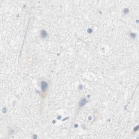 HPA IHC Cerebral cortex — HPGD