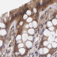 HPA IHC Colon — ARMCX1