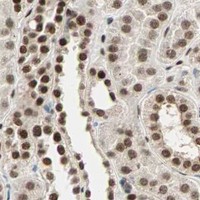 HPA IHC Kidney — BLM