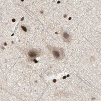 HPA IHC Cerebral cortex — BLM