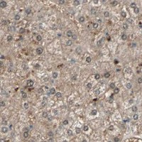 HPA IHC Liver — RTL6