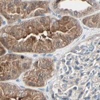HPA IHC Kidney — RTL6