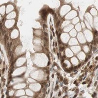 HPA IHC Colon — RPA3