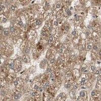 HPA IHC Liver — RPA3