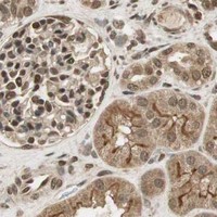 HPA IHC Kidney — RPA3
