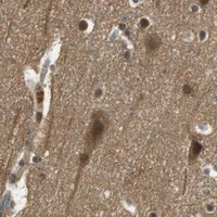 HPA IHC Cerebral cortex — RPA3
