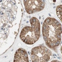 HPA IHC Kidney — SNX4